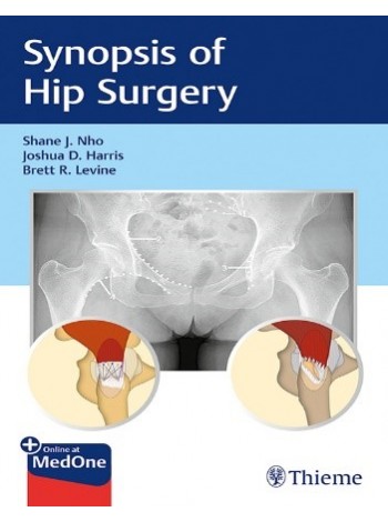 Synopsis of Hip Surgery
